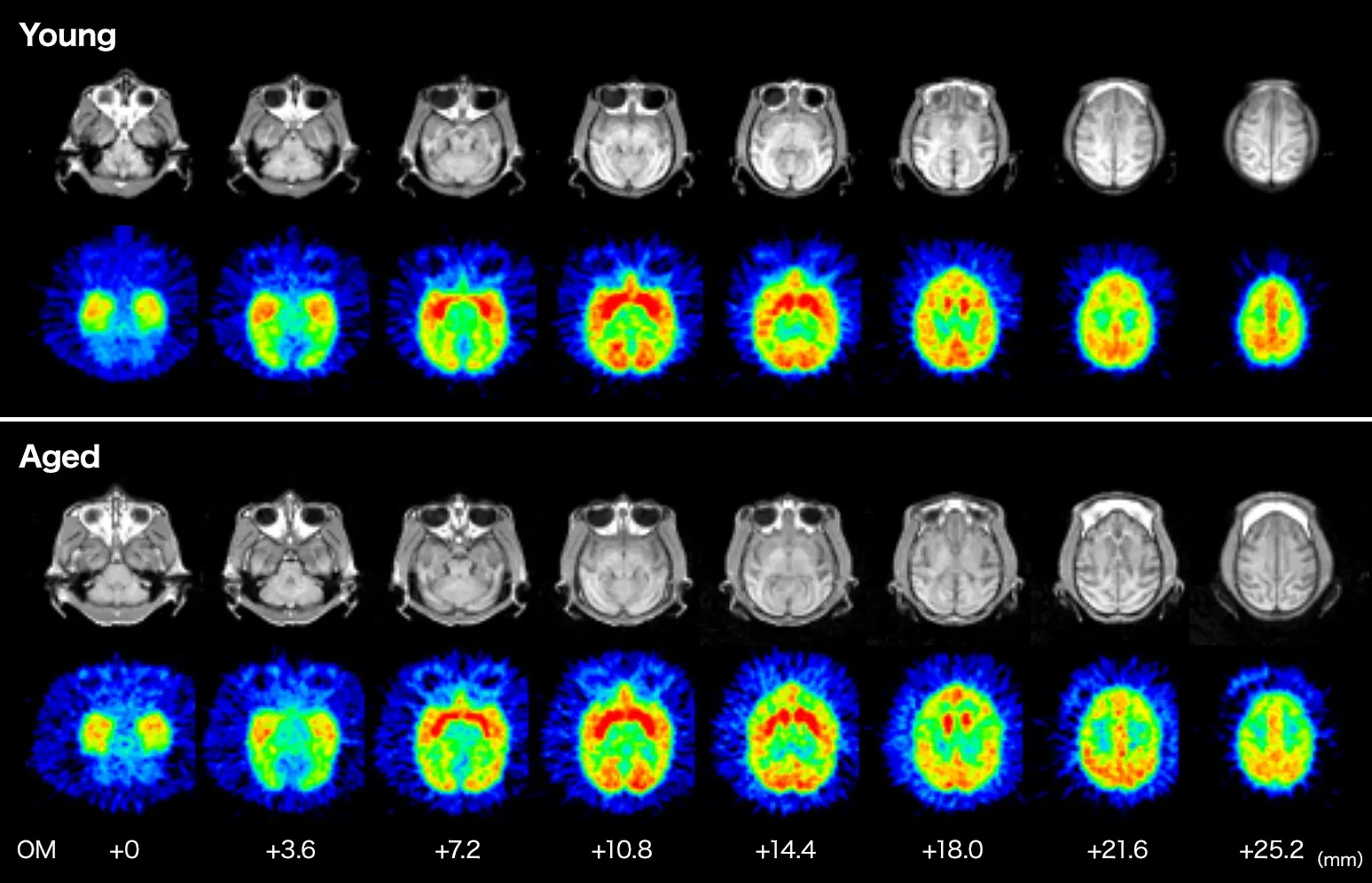 Effect of Aging on Muscarinic Receptorsin the Monkey Brain as Measured by [11C] (+)3-MPB