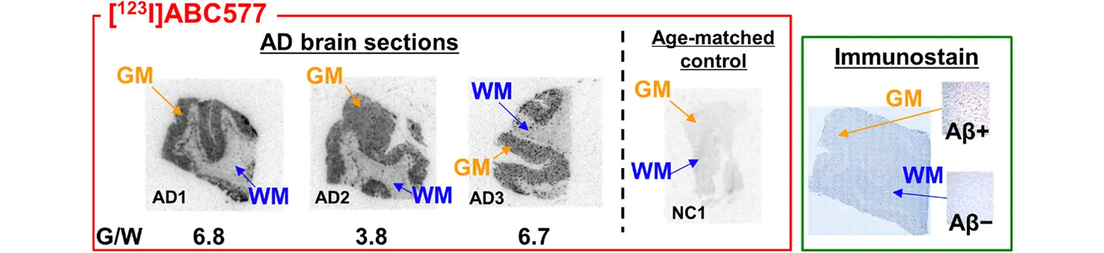 In vitro ARG of AD frontal lobe sections